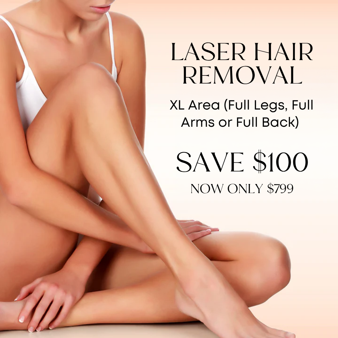 Laser Hair Removal – XL Area (Full Legs, Full Arms or Full Back) – Save $100