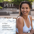 Peel Treatments