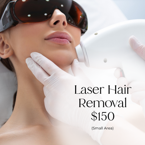Laser Hair Removal - $150 (Small Area)