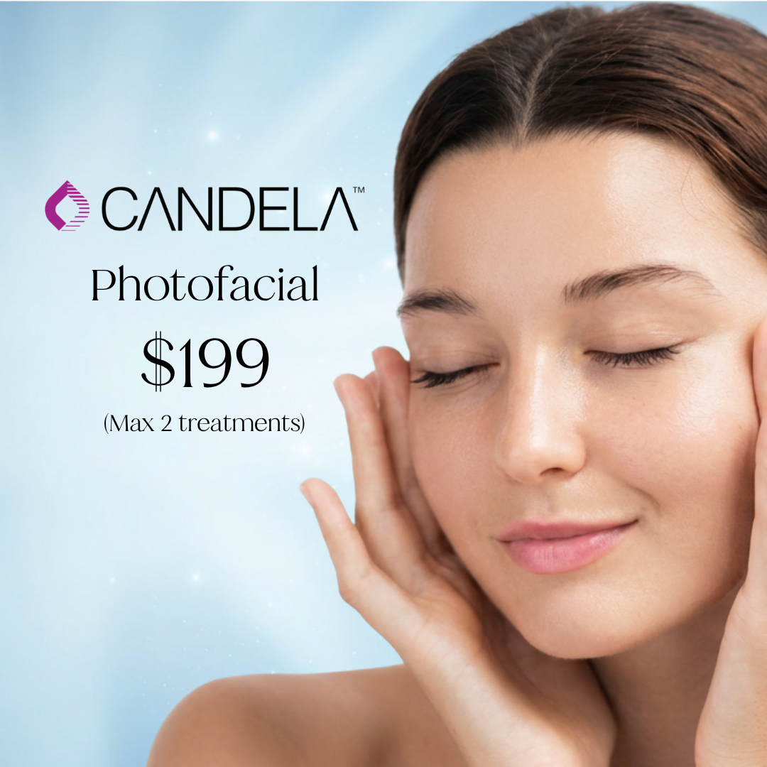 Photofacial Just $199 - Limit 2