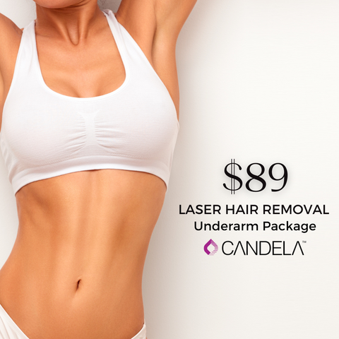 Laser Hair Removal - Underarm - 6 Sessions