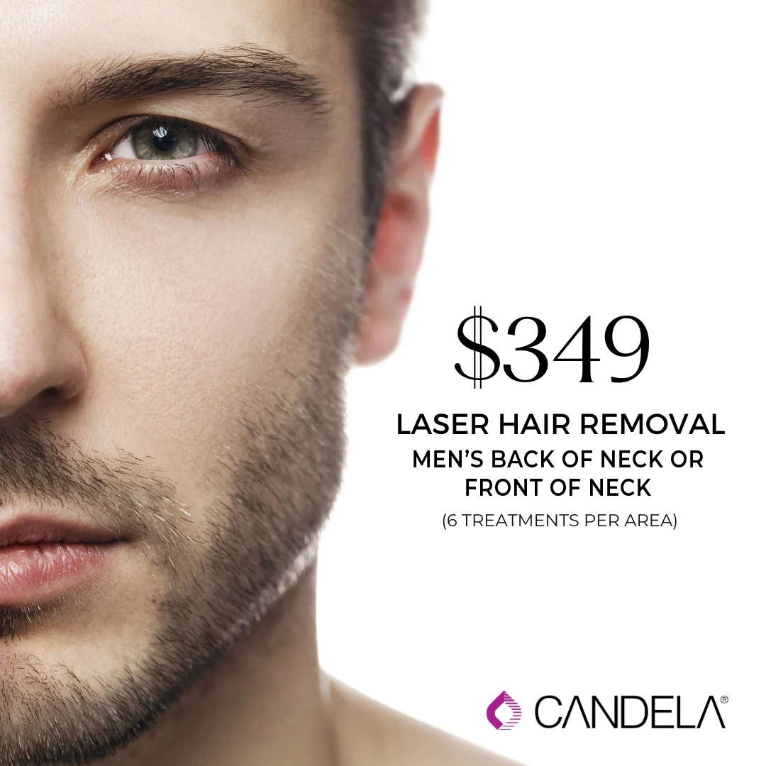 Laser Hair Removal - Beard or Back of Neck - 6 sessions