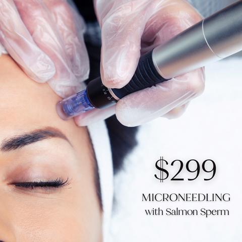 Microneedling with Salmon Sperm - Just $299