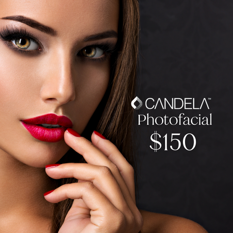 Photofacial Just $150 - Limit 4