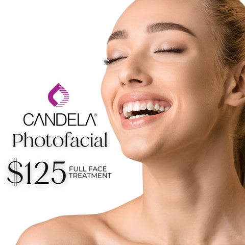 50% Off Photofacial with GentleMax Pro Pulsed Light Technology