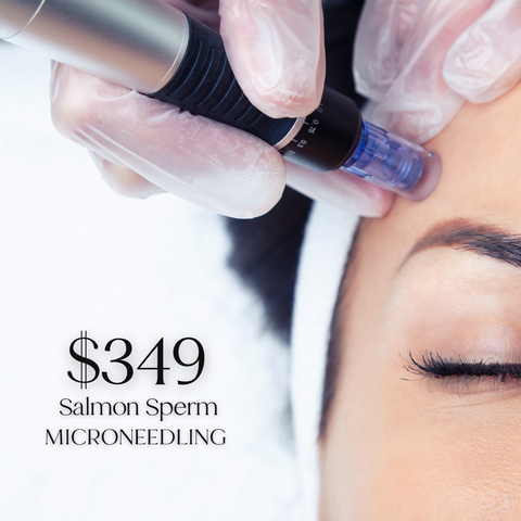 Microneedling with Salmon Sperm - Just $349